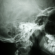 Illustration for article titled Dental X-Rays Linked to the Most Common Brain Tumors